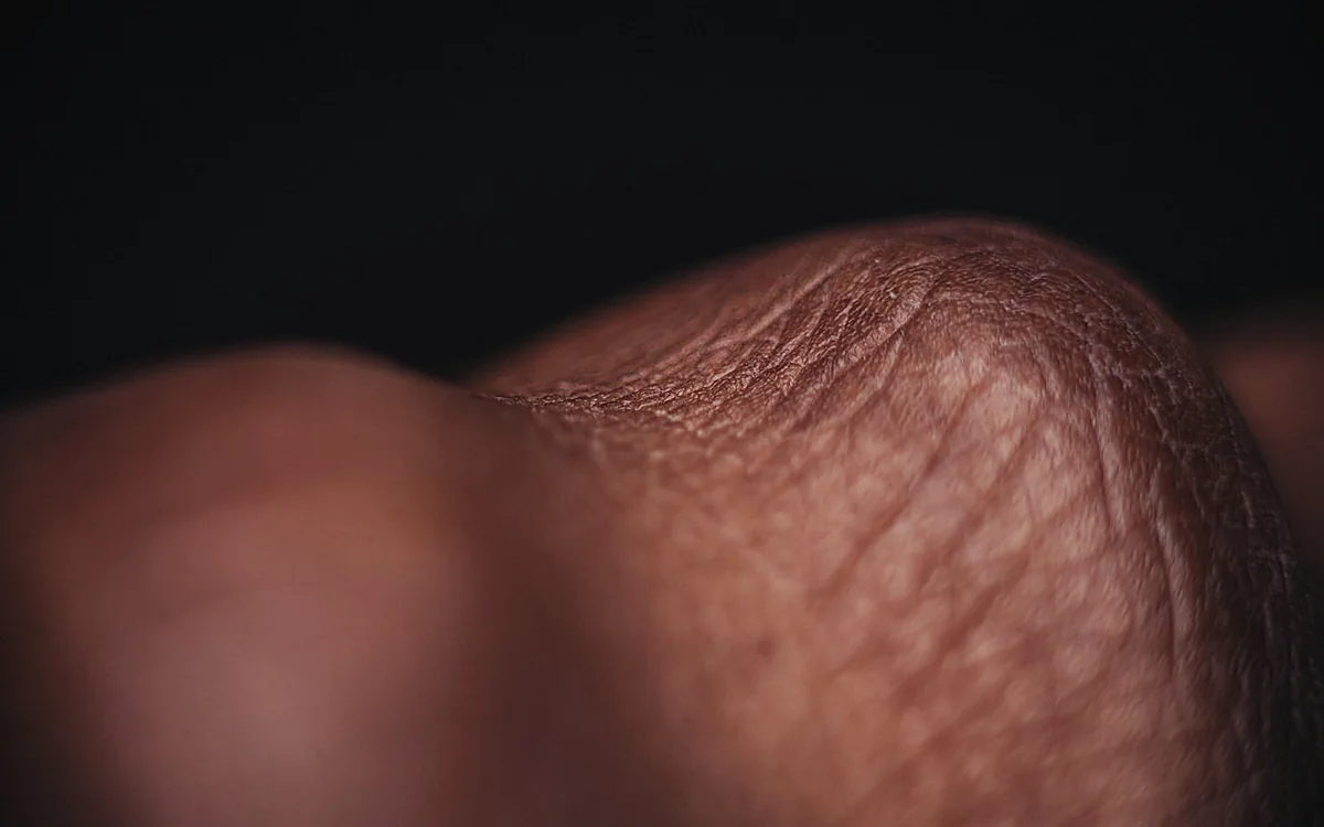 Controllo nei e dermatologia oncologica