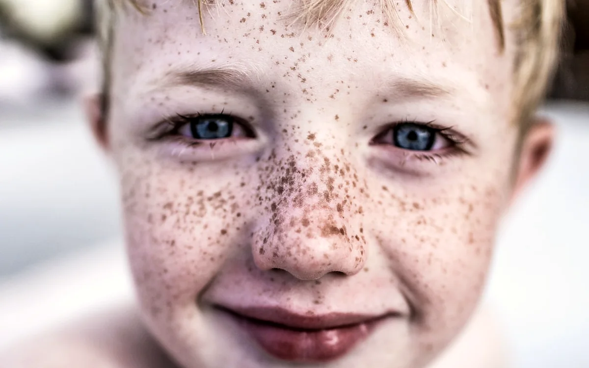 Dermatologia pediatrica